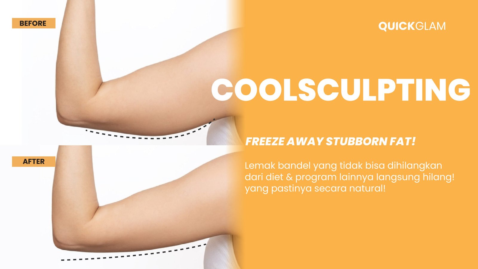 coolsculpting website